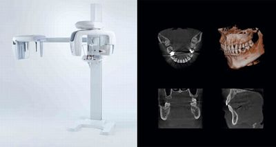 歯科用CT