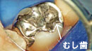 顕微鏡歯科の画像